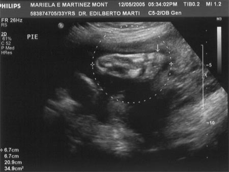 Sonograma 2