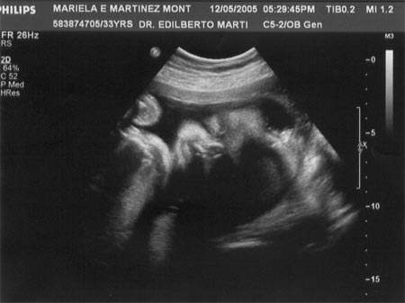Sonograma 3